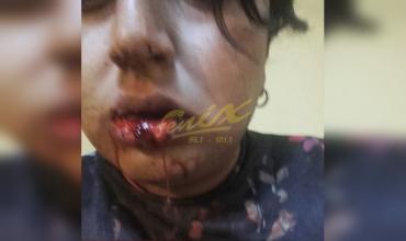 La Rioja: Denuncia que fue brutalmente golpeado por ser gay 