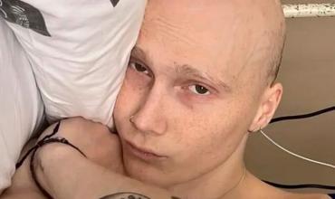 Murió Charlie: tenía 20 años y mostró el día a día de su cáncer en TikTok