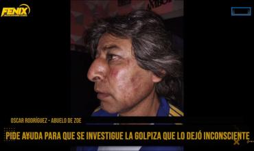 Chilecito: Un hombre fue brutalmente golpeado en la zona de las defensas y pide justicia