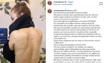 La confesión de Miriam Lanzoni: “Me costaba mirarme”