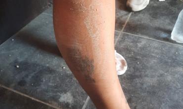 Pelea vecinal en barrio Santa Catalina dejó dos personas con lesiones leves