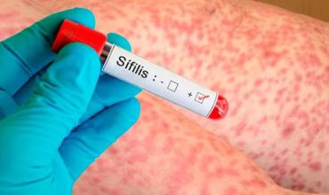 En Argentina se registraron más de 50 mil casos de sífilis