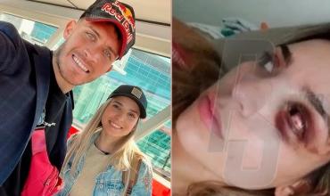 Condenaron a 15 años de prisión a Santiago Martínez por intento de femicidio contra Emily Ceco