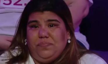 Camilota sufrió un accidente en su casa, mostró cómo quedó y hay preocupación por su salud