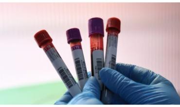 Dra. Claudia Nonaka sobre el hallazgo de un grupo sanguíneo raro: “Son personas que carecen de antígenos que el 99% de la población sí tiene”