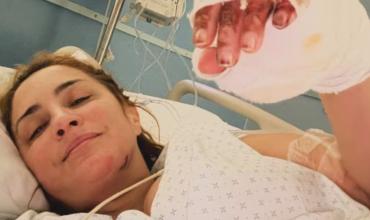 María Julia Oliván recordó el accidente que la obligó a atravesar 17 operaciones: “Podría haberme muerto”