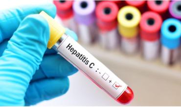 8 de cada 10 personas con hepatitis C aún no se trataron para curarse