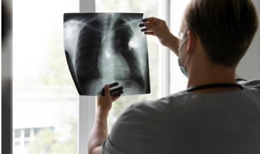 Derrame pleural: ¿qué es y cómo se detecta?
