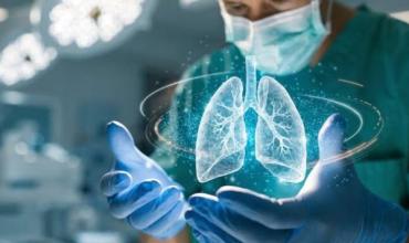 Nódulo pulmonar: ¿cómo se determina si es benigno o maligno?