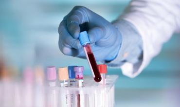 No es el colesterol: cuál es el valor que pocos miran en los análisis de sangre y puede ser clave