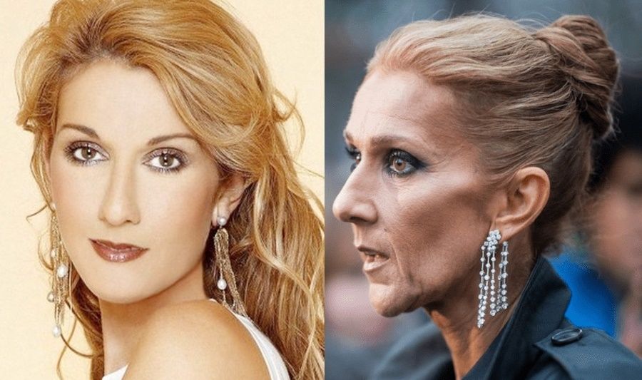 ¿Qué le pasa a Céline Dion?