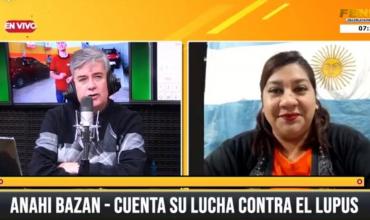 Joven riojana contó cómo es su lucha diaria contra el Lupus