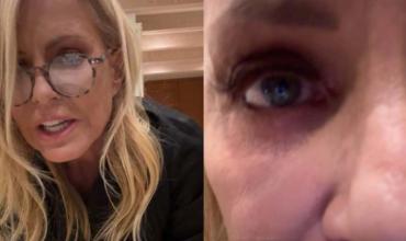 Cecilia Bolocco reveló que sufre una compleja enfermedad