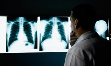Uruguay: El gobierno toma medidas ante el aumento de los casos de tuberculosis