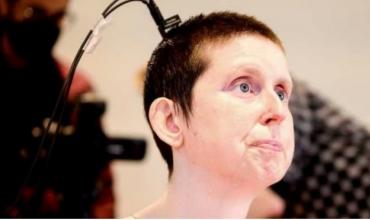 Una mujer cuadripléjica volvió a hablar después de 18 años gracias a un implante cerebral que utiliza IA