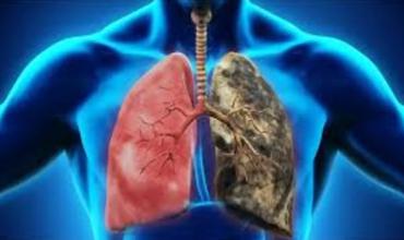 Alerta por el frío: las dos peligrosas enfermedades que se agravan y cómo proteger tu salud
