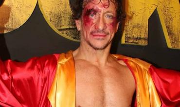Nico Vázquez suspendió las funciones de su obra "Rocky" por un problema de salud