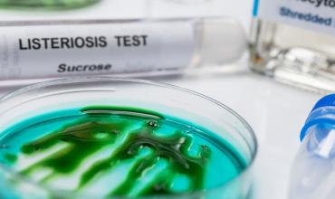 Alerta sanitaria: confirman brote de listeriosis por consumo de queso en Argentina