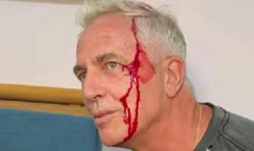 Marley se accidentó en Tailandia: "Quedé chorreando sangre"