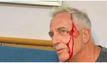El preocupante accidente que sufrió Marley en Tailandia mientras estaba grabando Por el mundo