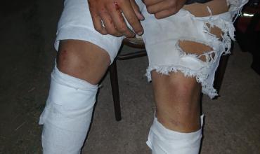 Un menor resultó herido tras caer de su moto al evadir un control policial en la Ruta 38