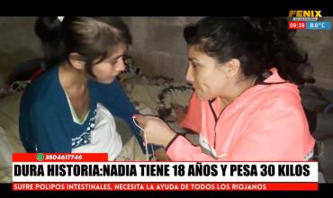 La historia de Nadia, la joven de 18 años que solo pesa 30 kilos por un problema en los intestinos 