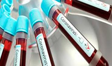 13/09 - Coronavirus en Argentina: confirmaron 89 muertes y 9.056 nuevos contagios en las últimas 24 horas