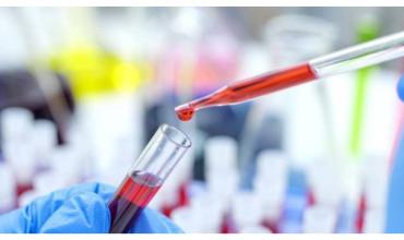 “El paciente de Oslo”: logran una nueva curación del VIH con un trasplante de células madre y por primera vez el donante fue un hermano