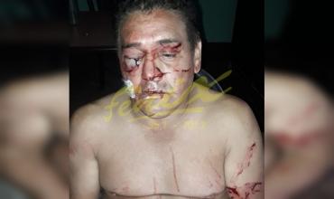 Chepes: un hombre fue salvajemente golpeado
