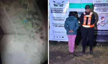 Tucumán: Detienen a joven que transportaba 90 cápsulas de cocaína en su estómago