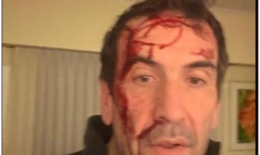 Atacaron a un candidato de La Libertad Avanza horas antes de las elecciones: "Le gatillaron dos veces"
